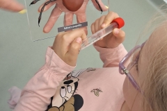 kleszcze2
